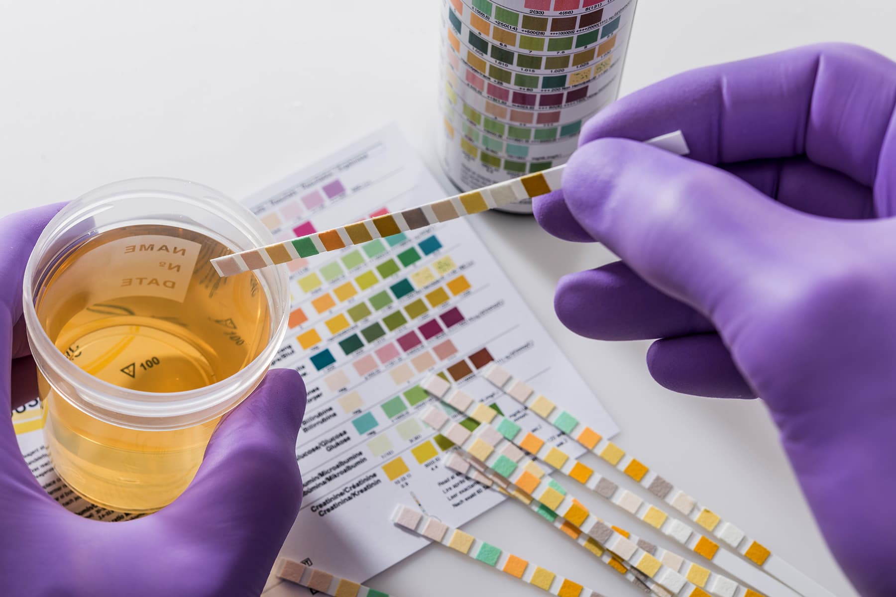 Drug testing services